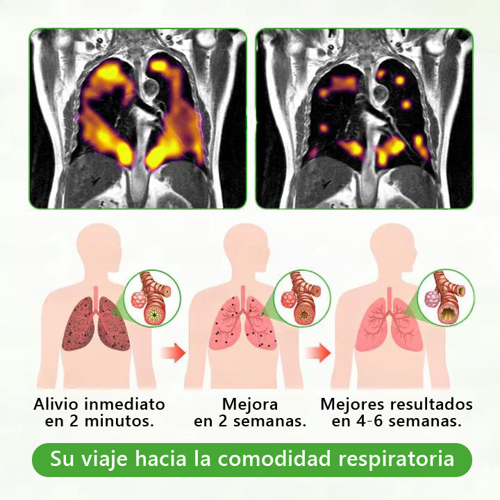 𝐓𝐢𝐞𝐧𝐝𝐚 𝐨𝐟𝐢𝐜𝐢𝐚𝐥 ✨𝐌𝐮𝐫𝑤𝗈𝒏® Difusor Botánico de Mullein para Limpieza de Pulmones (🫁 Tos, faringitis, dificultad para respirar, flema, congestión nasal, bronquitis, síntomas alérgicos, malestar pulmonar)3🎁